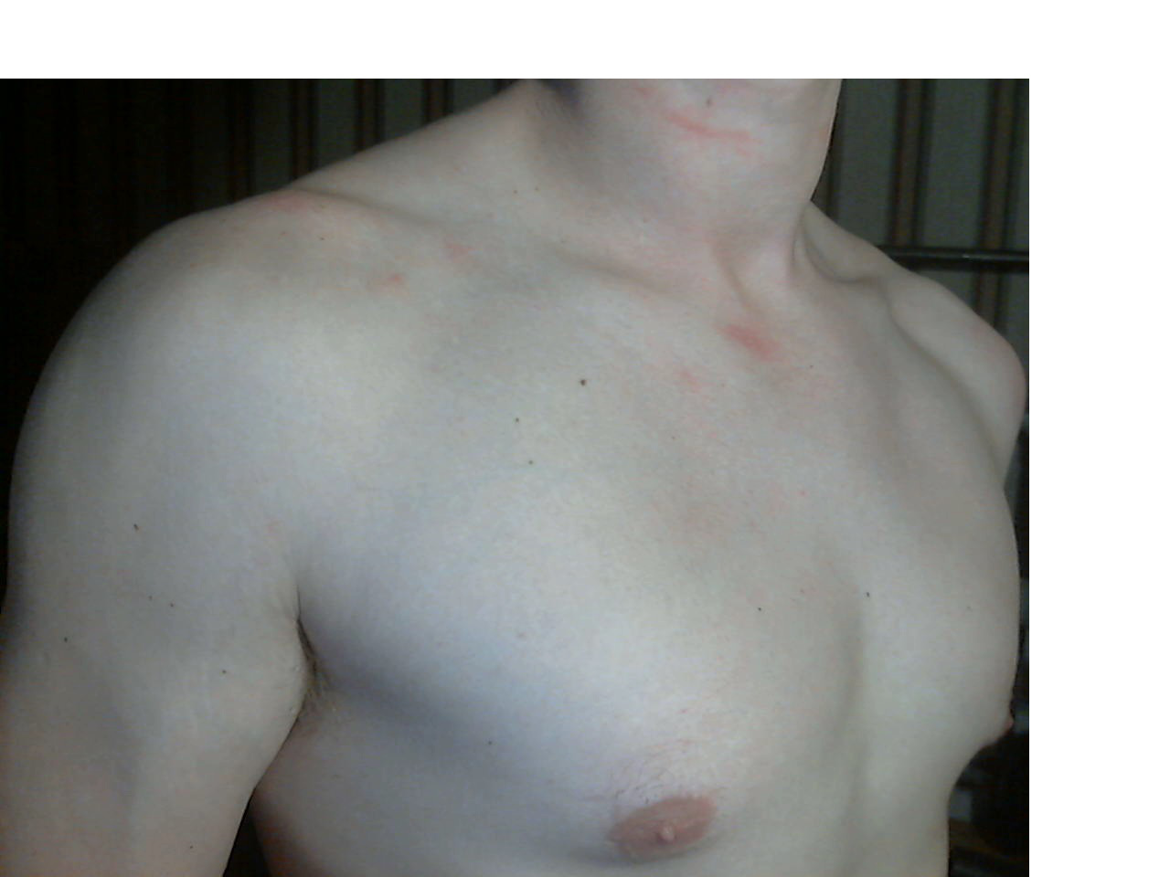 асимметрия груди у мужчин фото 105