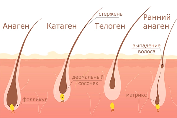 Схема причины очаговой алопеции